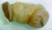 [IMG: The non-penile bacterial mould]